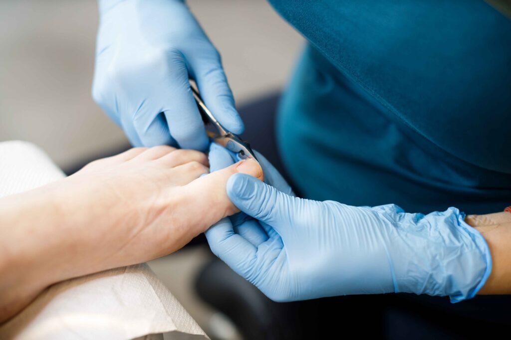 Pedichiura Clasica Art Pedi Bacau Pedichiura Clasica Art Pedi Bacau