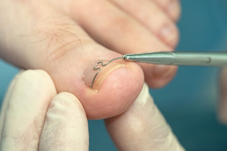 Pedichiura Clasica Art Pedi Bacau